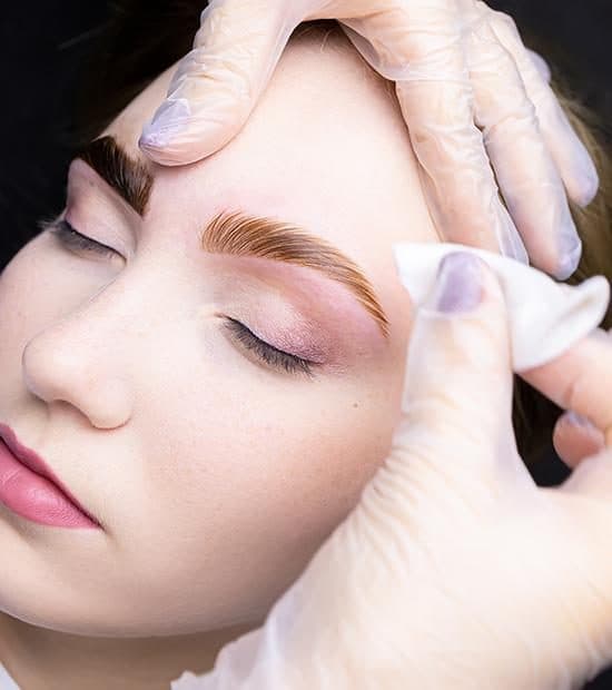 Sourcil restructuré et peigné vers le haut en fin de browlift, essuyé au coton par une main gantée.