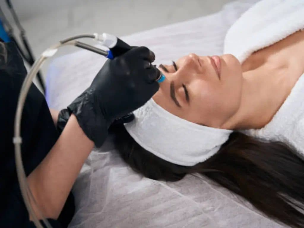 Embout d’hydrodermabrasion relié à son tuyau, passé sur le visage d’une cliente allongée, bandeau éponge sur les cheveux, par une main gantée de noir.